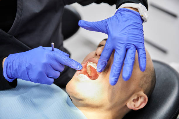 Best Emergency Dentist for Lost Fillings or Crowns in Plymouth, NC