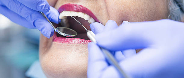 Best Emergency Dental Extractions in Plymouth, NC